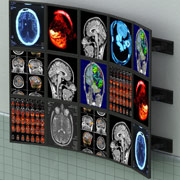 video wall